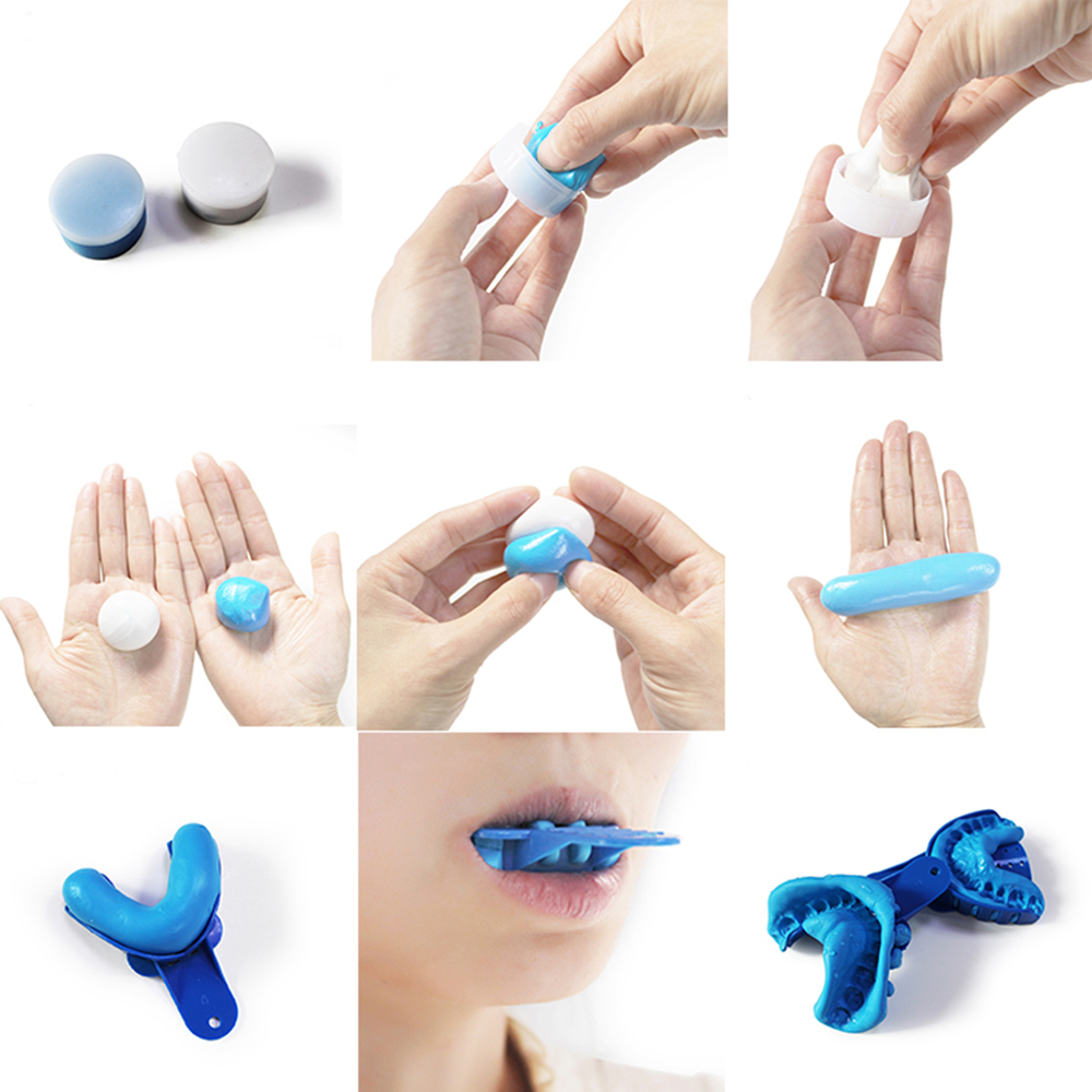 Dental Impression Material Kit - Luxsmile Dental zestaw do wyciskania klinicznego