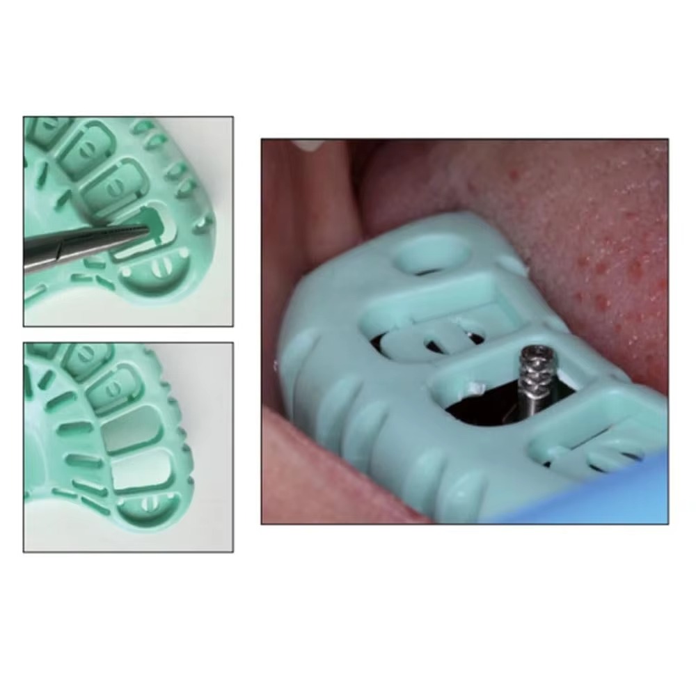 FULAIGE 6 szt./zestaw Jednoraz – Dental Impression Material Kit recenzja i cena