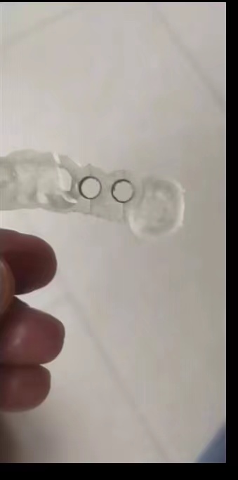 Żywica dentystyczna drukarka 3 – Dental 3D Printer Resin recenzja i cena