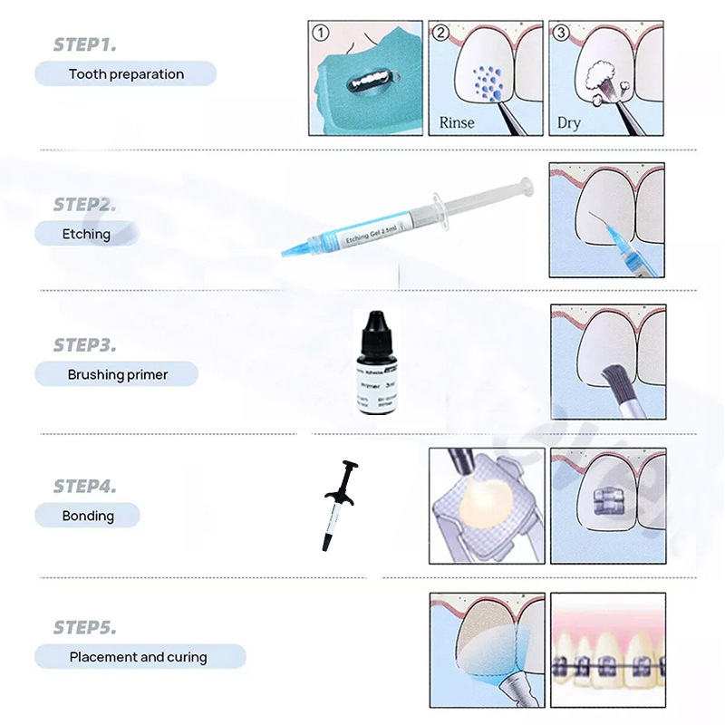 Zestaw do ortodoncji: światłou – Dental Impression Material Kit recenzja i cena